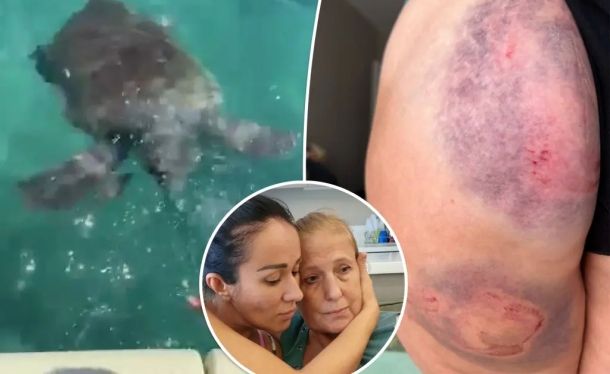 В Анталье на купающуюся россиянку напала черепаха