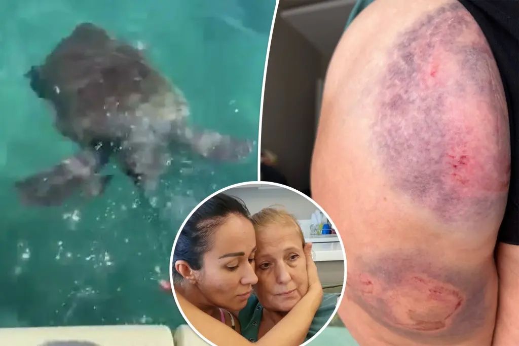 В Анталье на купающуюся россиянку напала черепаха